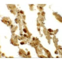 ESRP2 / RBM35B Antibody