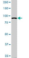 IHC-plus™ Monoclonal Mouse anti-Human ACTN4 Antibody (clone 4D10, IHC, IF, WB)