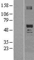 OXCT2 Protein (Over-Expression Lysate Myc-DDK (Flag))