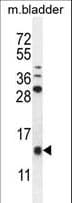 KRTCAP2 Antibody (aa134-162)