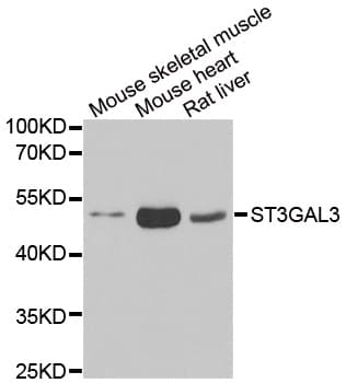 ST3GAL3 / ST3N Antibody
