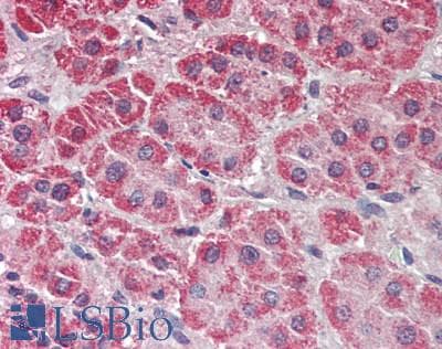 IHC-plus™ Polyclonal Rabbit anti-Human IKBKAP / IKAP Antibody (aa1150-1200, IHC, WB)