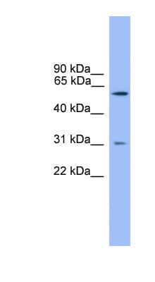Polyclonal Rabbit anti-Human PCSK2 Antibody (aa351-400, WB)