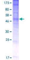 Human PGAP3 / PERLD1 Protein (Recombinant GST)
