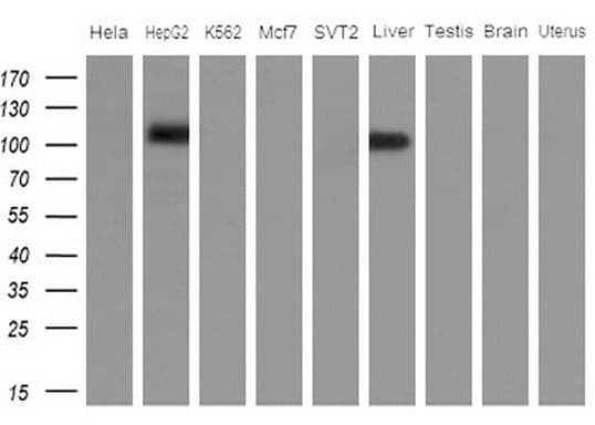 APOBR / APOB48R Antibody (aa780-1088, clone OTI2E6)