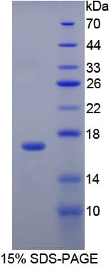 Rabbit SELE / CD62E / E-selectin Protein (Recombinant His-T7)