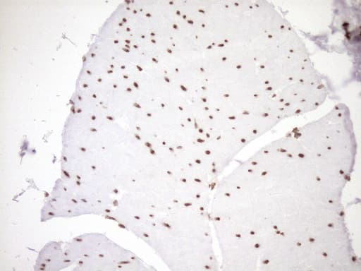 EXOSC1 / CSL4 Antibody (clone OTI1H9)