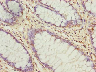 ARMT1 Antibody
