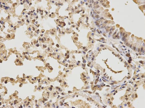 Polyclonal Rabbit anti-Human CDK4 Antibody (IHC, IF, WB)