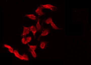 Polyclonal Rabbit anti-Human ULK3 Antibody (IHC, IF, WB)