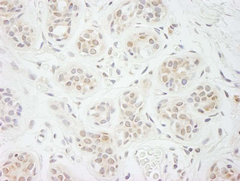 Polyclonal Rabbit anti-Human EIF2A / EIF2 Alpha Antibody (aa450-500, IHC)