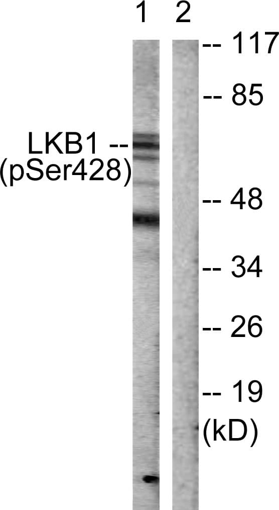 STK11 / LKB1 Antibody (phospho-Ser428)