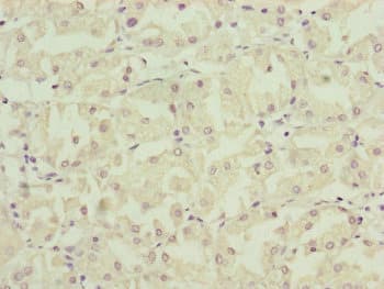 NDUFA12 / B17.2 Antibody