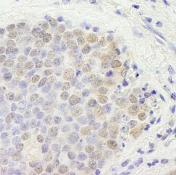 GATAD2B Antibody (aa50-100)