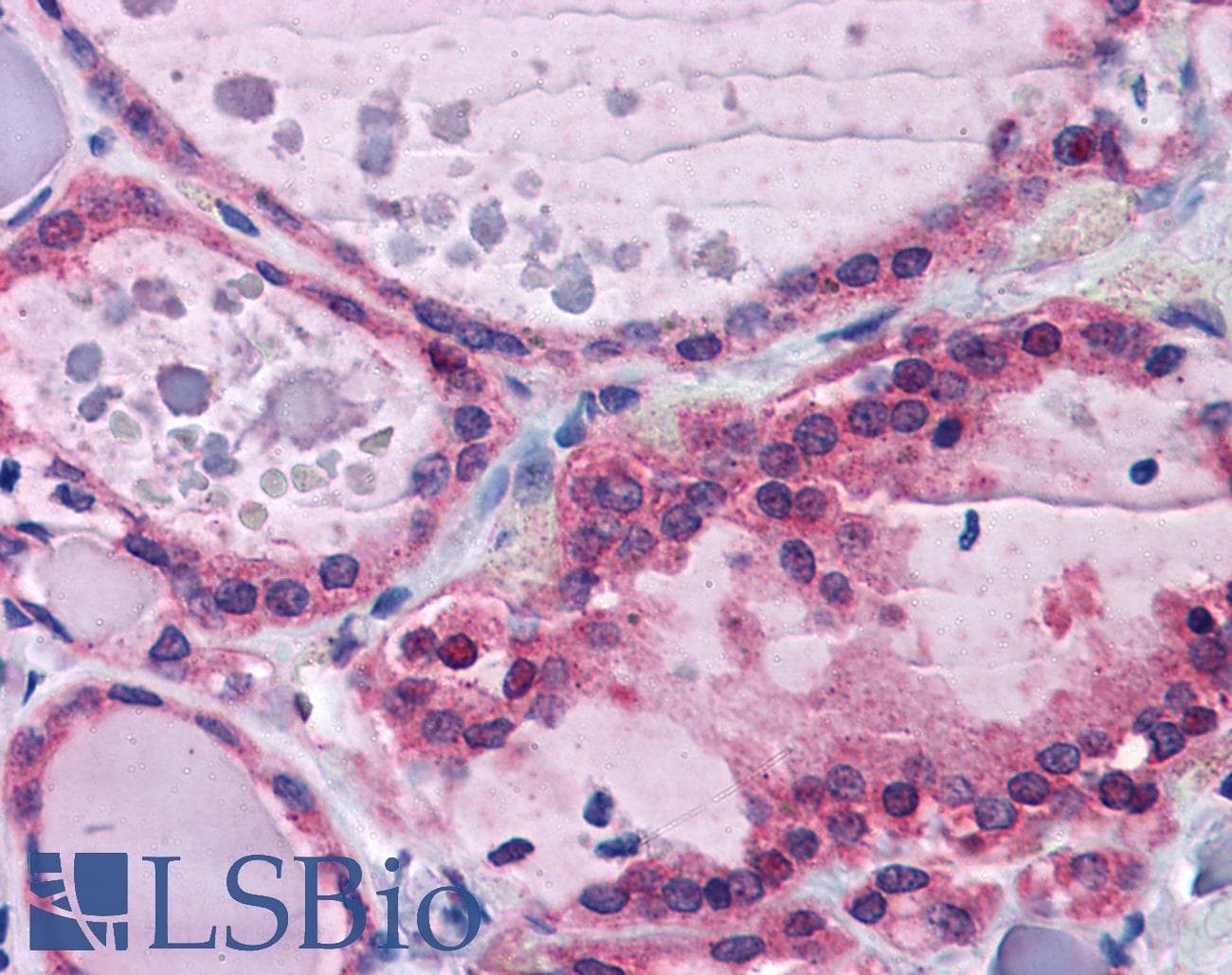 IHC-plus™ Polyclonal Goat anti-Human PPP2R1A Antibody (aa576-589, IHC, WB)