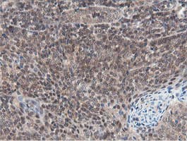 OTUB1 / OTU1 Antibody (clone OTI5B8)
