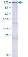 Human ZFYVE16 Protein (Recombinant GST)
