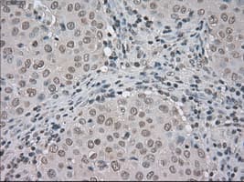 BUB1B / BubR1 Antibody (clone OTI5D9)