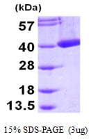 Human CRYM Protein (Recombinant His)