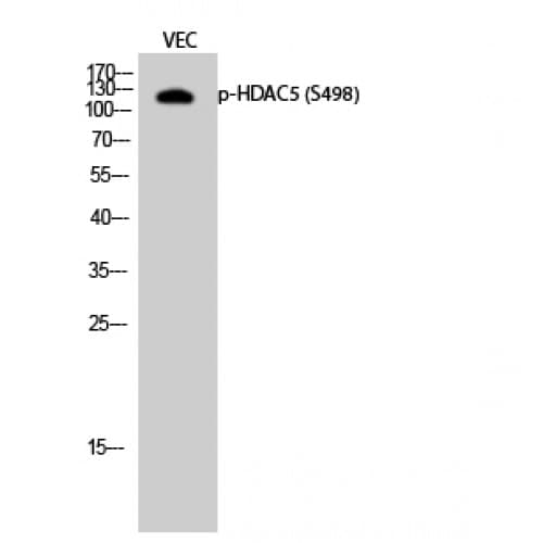 HDAC5 Antibody (440-520 aa)