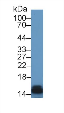 FABP3 / H-FABP Antibody (aa1-133)