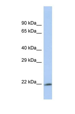PSMA6 Antibody (N-Terminus)