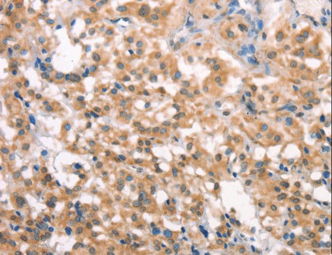 LATS2 Antibody