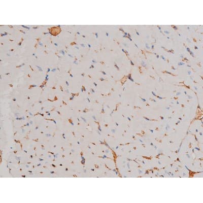 Polyclonal Rabbit anti-Human CDC25A Antibody (phospho-Ser124, IHC, IF, WB)