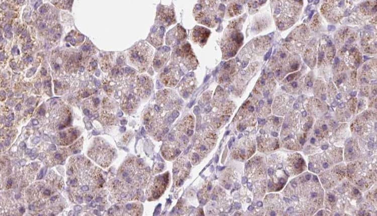 DNAJC19 Antibody