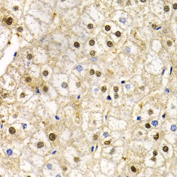 Polyclonal Rabbit anti-Human RAD9A / RAD9 Antibody (IHC, IF, WB)