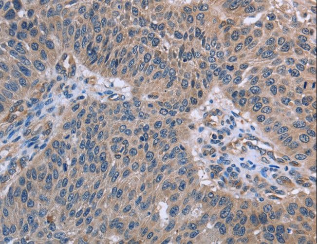 Polyclonal Rabbit anti-Human RNF144B Antibody (IHC, WB)