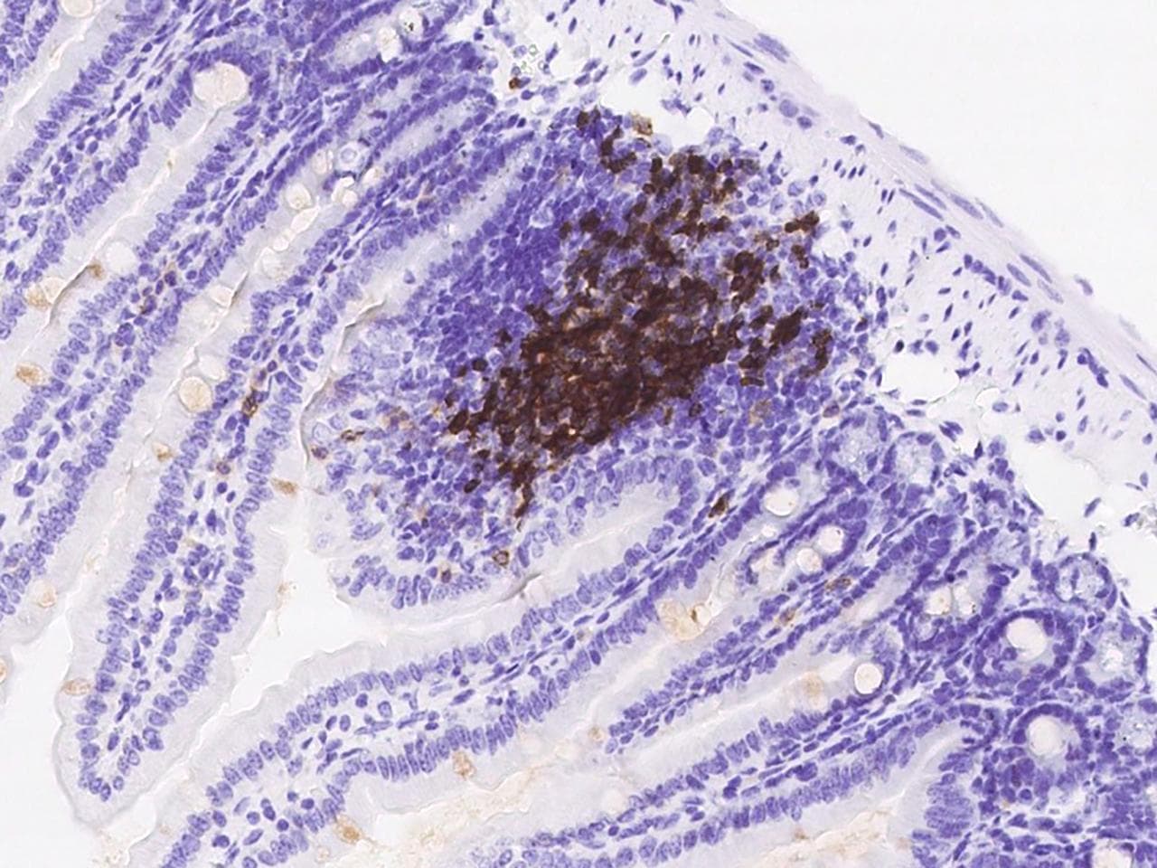 CD79B / CD79 Beta Antibody (clone 003, Preservative Free)
