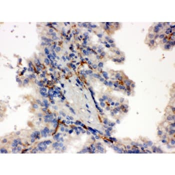CYP27B1 Antibody (aa475-508)