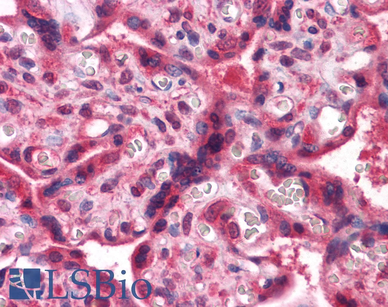 IHC-plus™ NME1 / NM23 Antibody (clone 4B2)