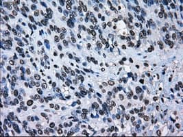 ERCC1 Antibody (clone OTI1A3)