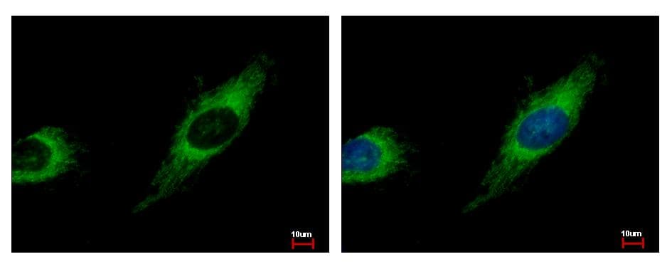 TBRG4 Antibody