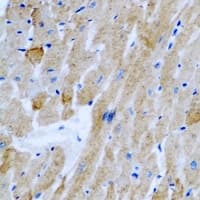OGT / O-GLCNAC Antibody