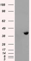 PME-1 / PPME1 Antibody (clone OTI7F12)