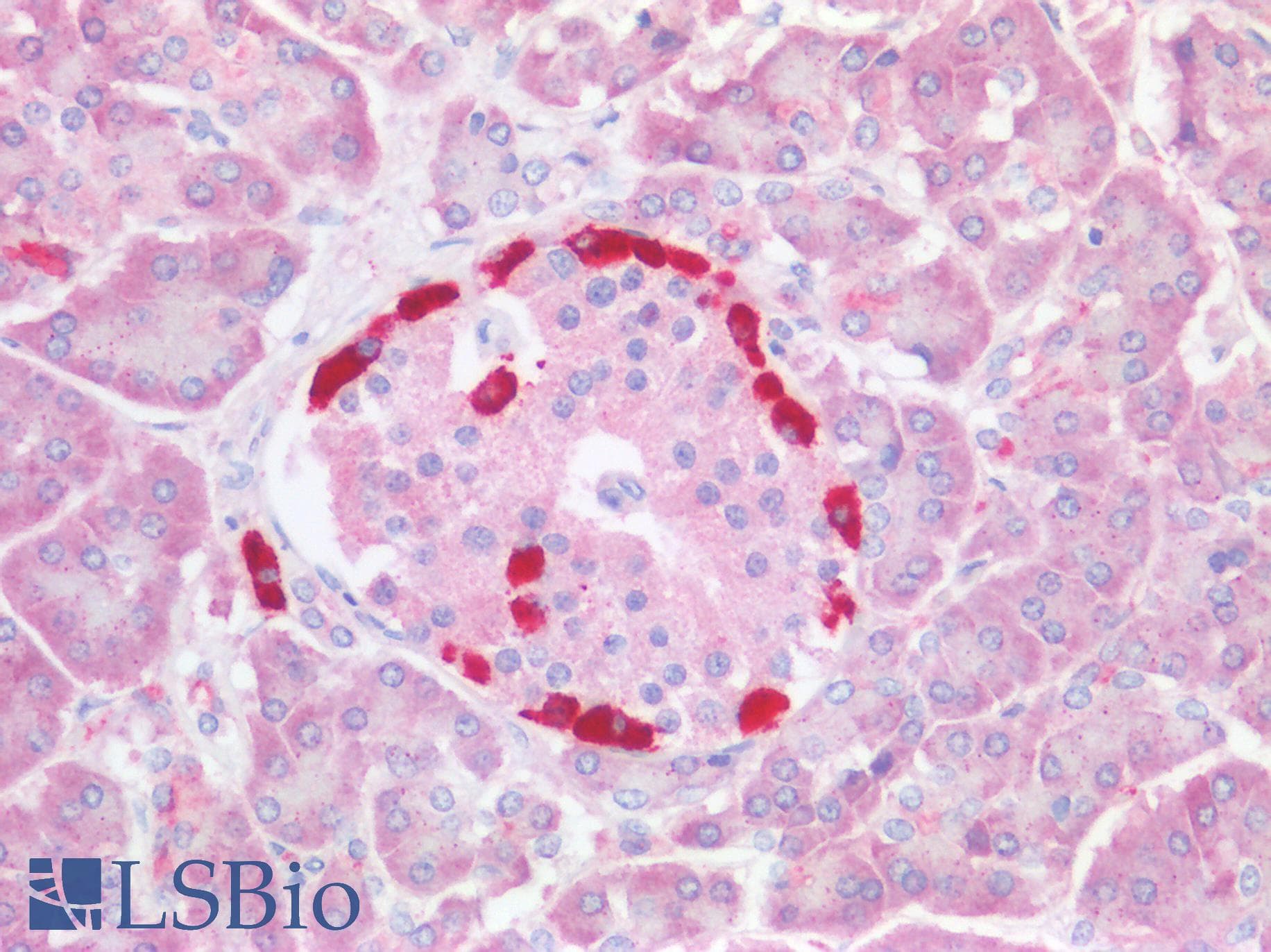 IHC-plus™ SQSTM1 Antibody