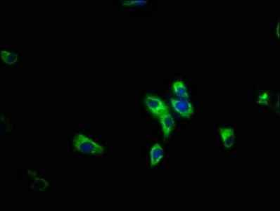 IHC-plus™ Polyclonal Rabbit anti-Human PIK3R5 Antibody (aa1-494, IHC)