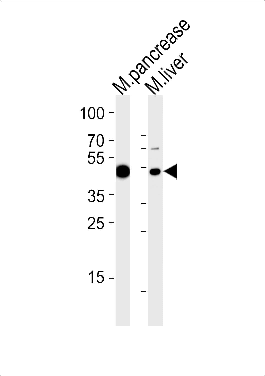 TBXT / T / Brachyury Antibody (aa408-442)