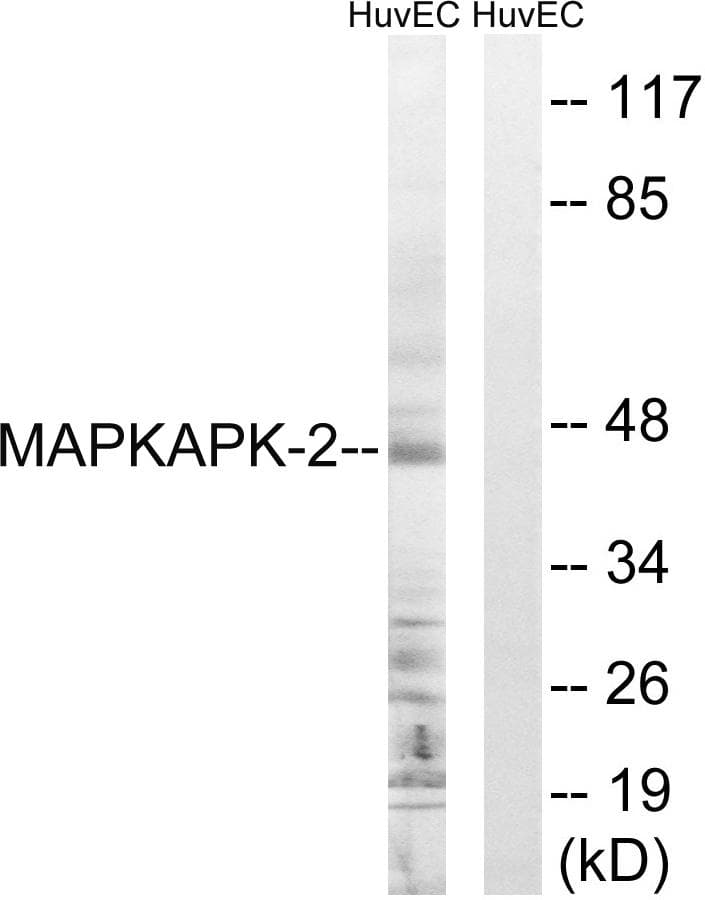 Polyclonal Rabbit anti-Human MAPKAPK2 / MAPKAP Kinase 2 Antibody (p222, IHC, WB)