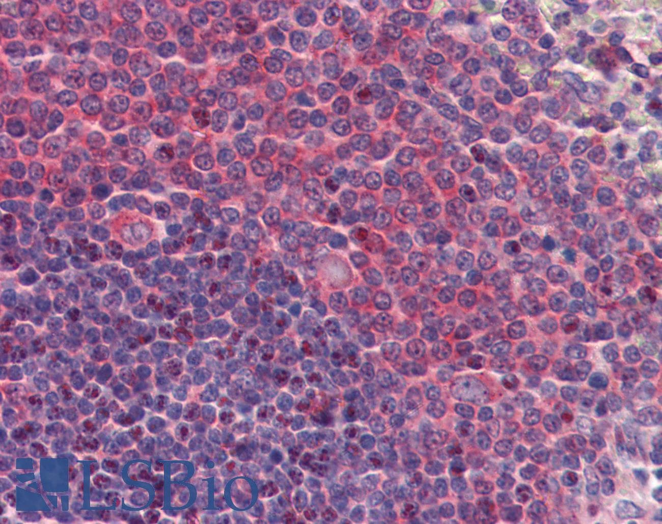 IHC-plus™ AAK1 Antibody