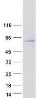 Human HERPUD1 / HERP Protein (Recombinant Myc-DDK (Flag))