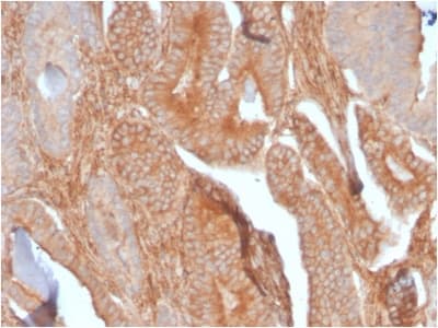 CD81 Antibody (clone C81/2885R, Azide-free, Carrier-free)