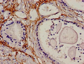 Polyclonal Rabbit anti-Human PIP / GCDFP-15 Antibody (WB)