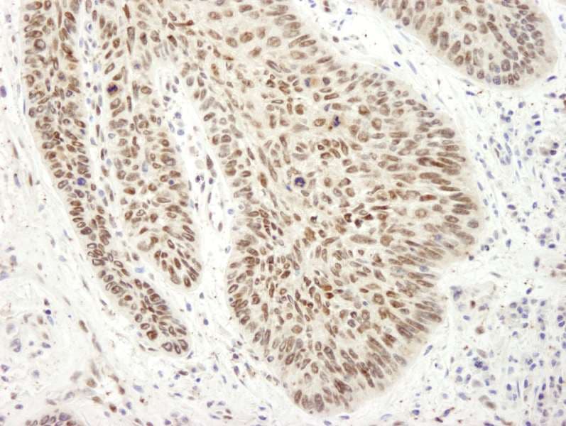 EWSR1 / EWS Antibody (aa100-150)