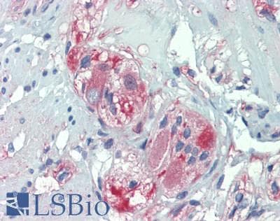 Polyclonal Rabbit anti-Mouse ANO1 / DOG1 / TMEM16A Antibody (aa20-239, IHC, WB)
