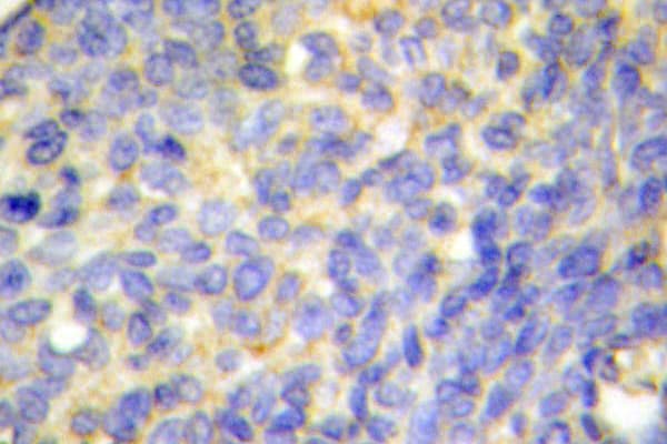 DFFA / ICAD / DFF45 Antibody (Gln177)