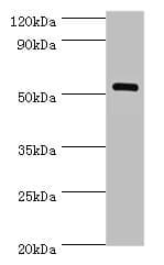 MEF2C Antibody (aa170-380)